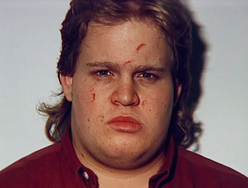 Caleb Fairley with the scratches he was attempting to hide from detectives (source: Youtube)