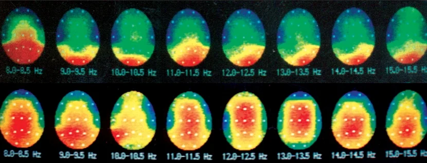 NeuroSpa02.jpg