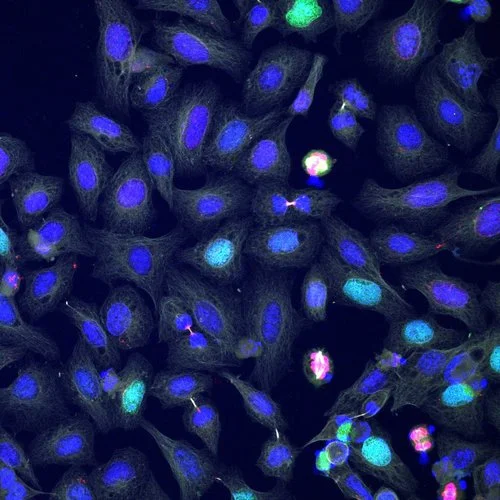 HM90-DreamFect_kif18b-gfp_2.jpg
