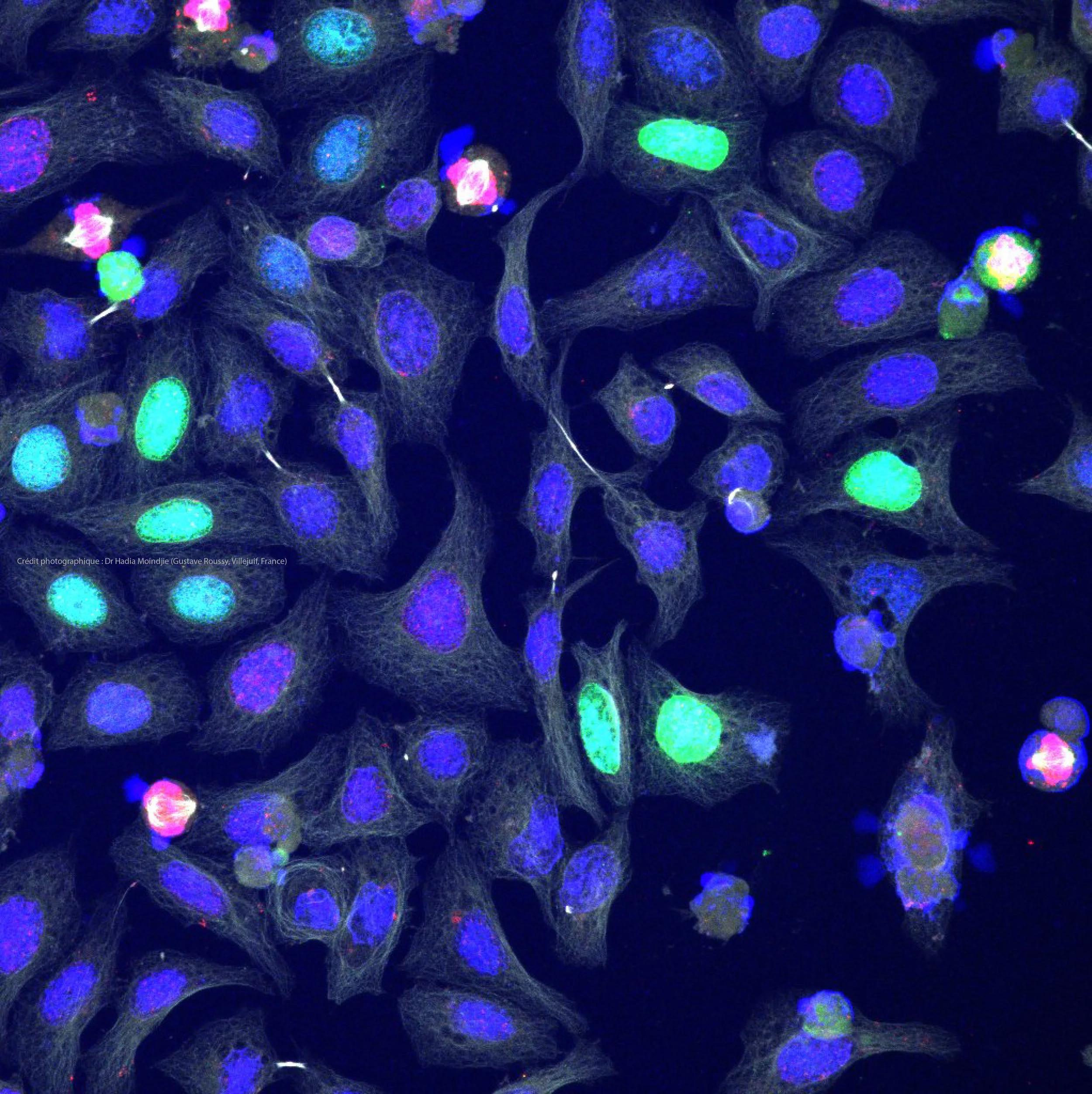 HM90-DreamFect_kif18b-gfp_3+crédit.jpg
