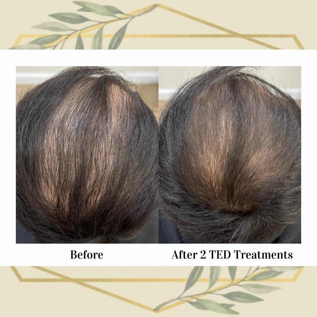 6 weeks pot 2 treatments (TikTok Photo Mode 916) - 16.jpeg