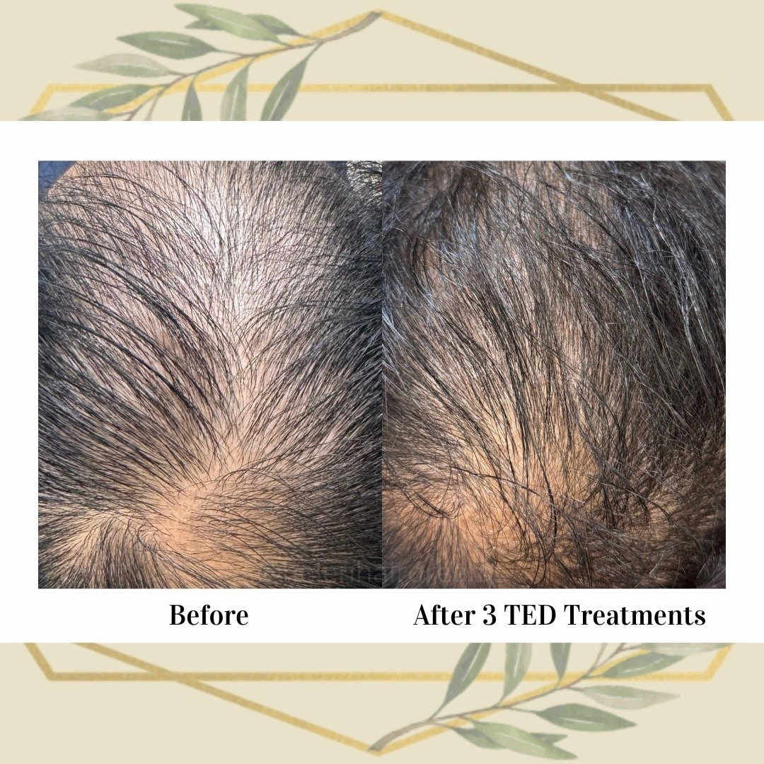 6 weeks pot 2 treatments (TikTok Photo Mode 916) - 10.jpeg