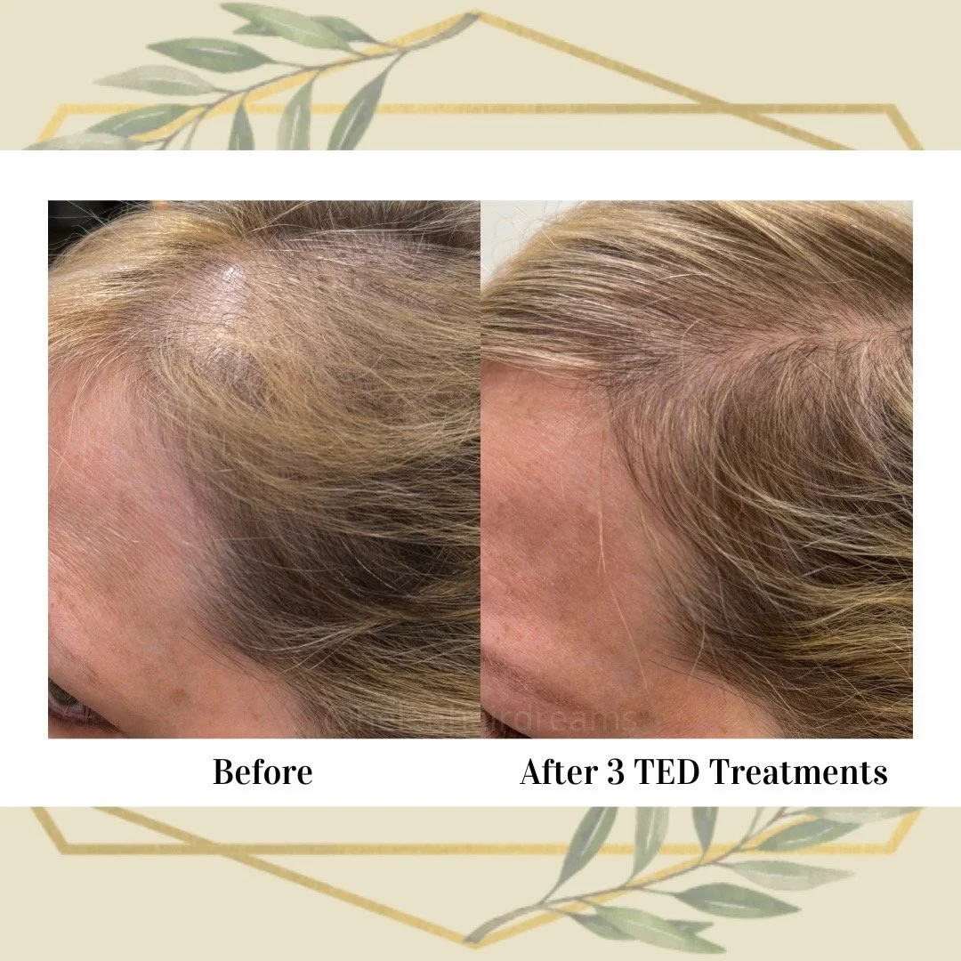 6 weeks pot 2 treatments (TikTok Photo Mode 916) - 9.jpeg