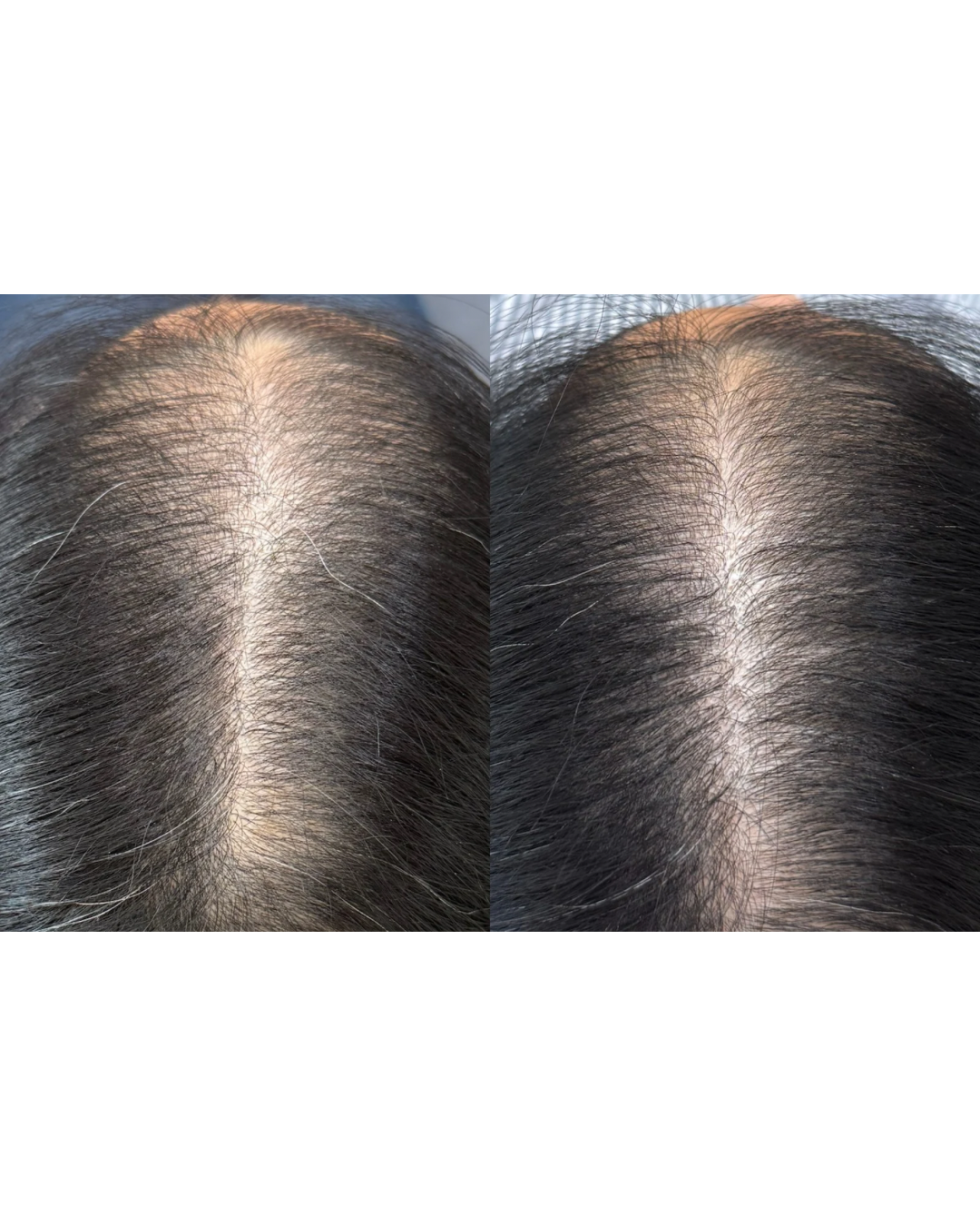 Comparison of a person’s scalp showing hair thinning or graying on the left and improved hair density and color on the right.