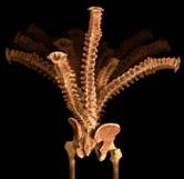 back_pain_clip_image002.jpg