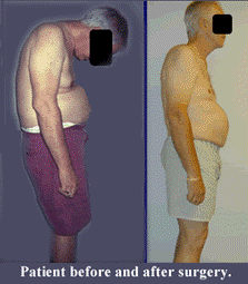 inflammatory_clip_image006.gif