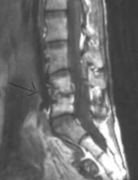 inflammatory_clip_image002.jpg