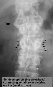 inflammatory_clip_image008.jpg