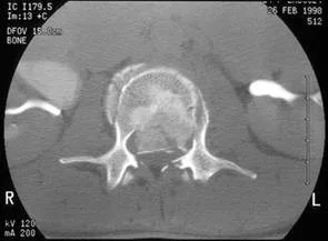 trauma_clip_image006.jpg