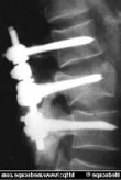 trauma_clip_image004.jpg