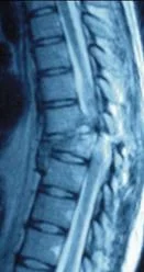 neck_pain_trauma_clip_image031.jpg
