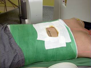 osteoporosis_clip_image021.jpg