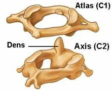 neck_pain_inflammatory_clip_image002.jpg