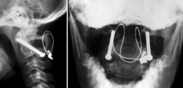 neck_pain_inflammatory_clip_image010.jpg