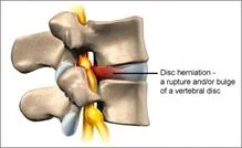 neck_pain_trauma_clip_image006.jpg