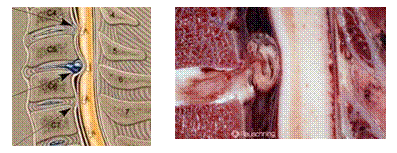 neck_pain_trauma_clip_image007.gif