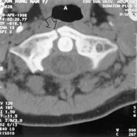 neck_pain_trauma_clip_image009.jpg