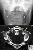 neck_pain_trauma_clip_image011.jpg
