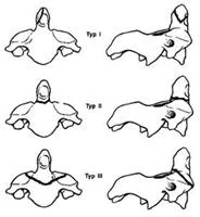 neck_pain_trauma_clip_image013.jpg