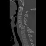 neck_pain_trauma_clip_image025.jpg