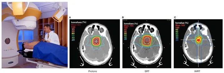 Radiation_therapy.jpg