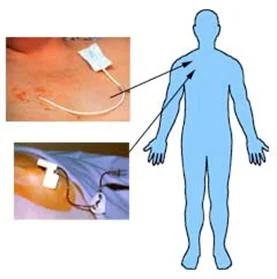 brain_tumours_clip_image025_0000.jpg