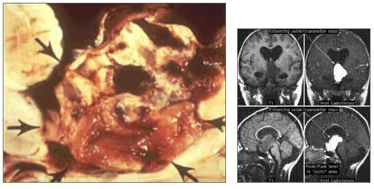 pituitary.jpg