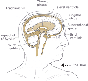 hydrocephalus cerebrospinal nph csf drainage