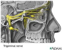 trigeminal_Neuralgia_clip_image006.jpg