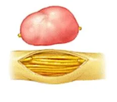 periferal_nerves_clip_image004.jpg