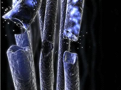 periferal_nerves_clip_image006.jpg