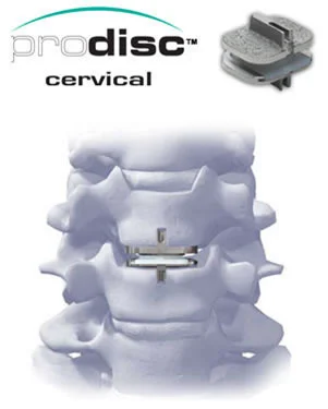 prodisc_cervical.jpg