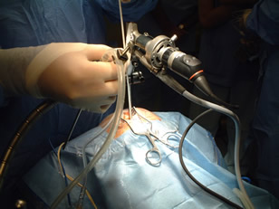 Ventriculoscopy_031.jpg