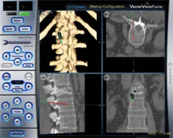 Neuronavigation_spine.jpg