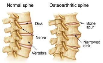 abnormal_spinal_clip_image002.jpg