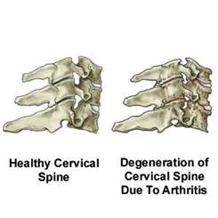 abnormal_spinal_clip_image004.jpg