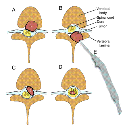 neck_pain_tumours_clip_image002.gif