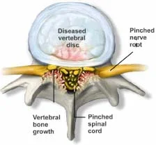 mechanical_disorders_clip_image009.jpg