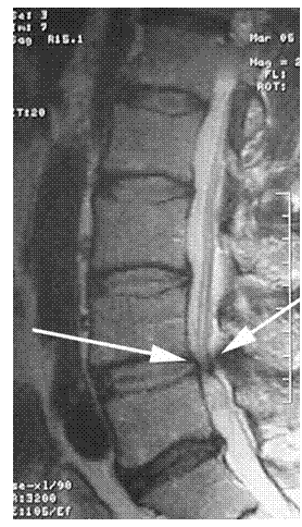 mechanical_disorders_clip_image011.gif
