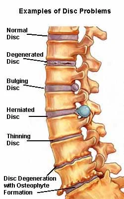 mechanical_disorders_clip_image001 (2).jpg