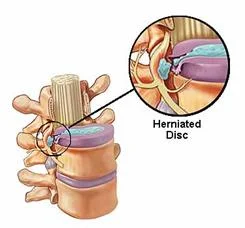 mechanical_disorders_clip_image013.jpg