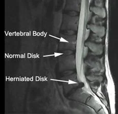 mechanical_disorders_clip_image015.jpg