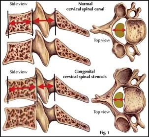 neck_pain_mechanical_disorders_clip_image007.jpg