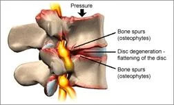neck_pain_mechanical_disorders_clip_image009.jpg
