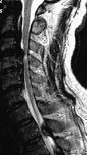 neck_pain_mechanical_disorders_clip_image011.jpg