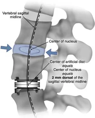 vertebral.jpg