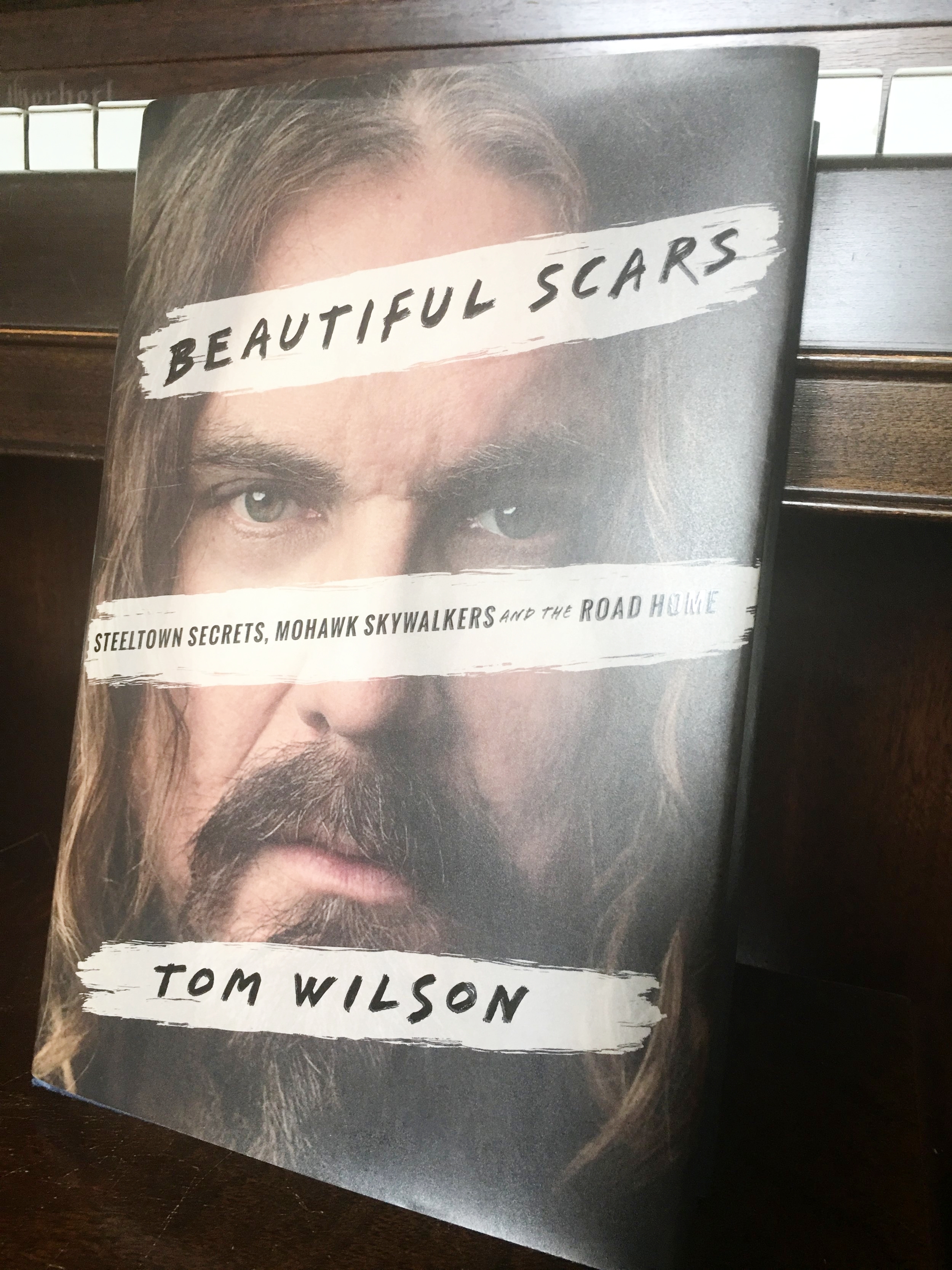 beautiful_scars.jpeg