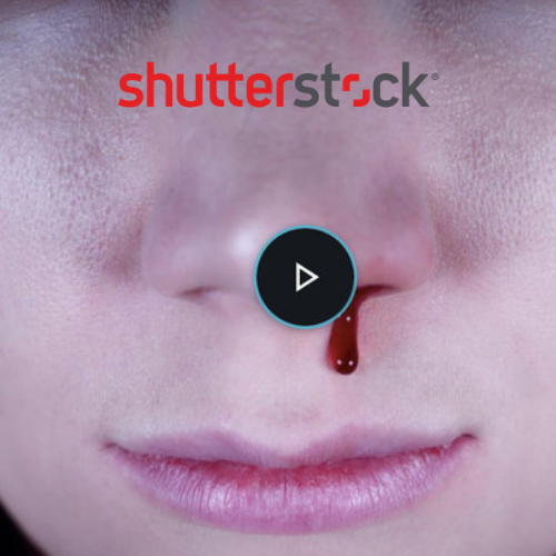 shutter.png