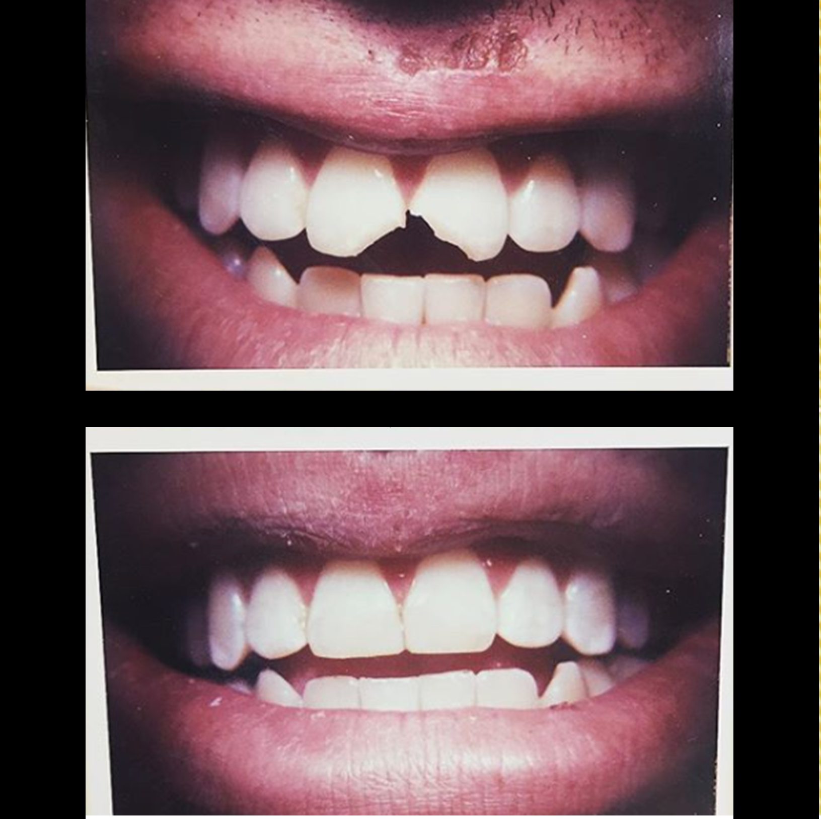 before and after for website.png
