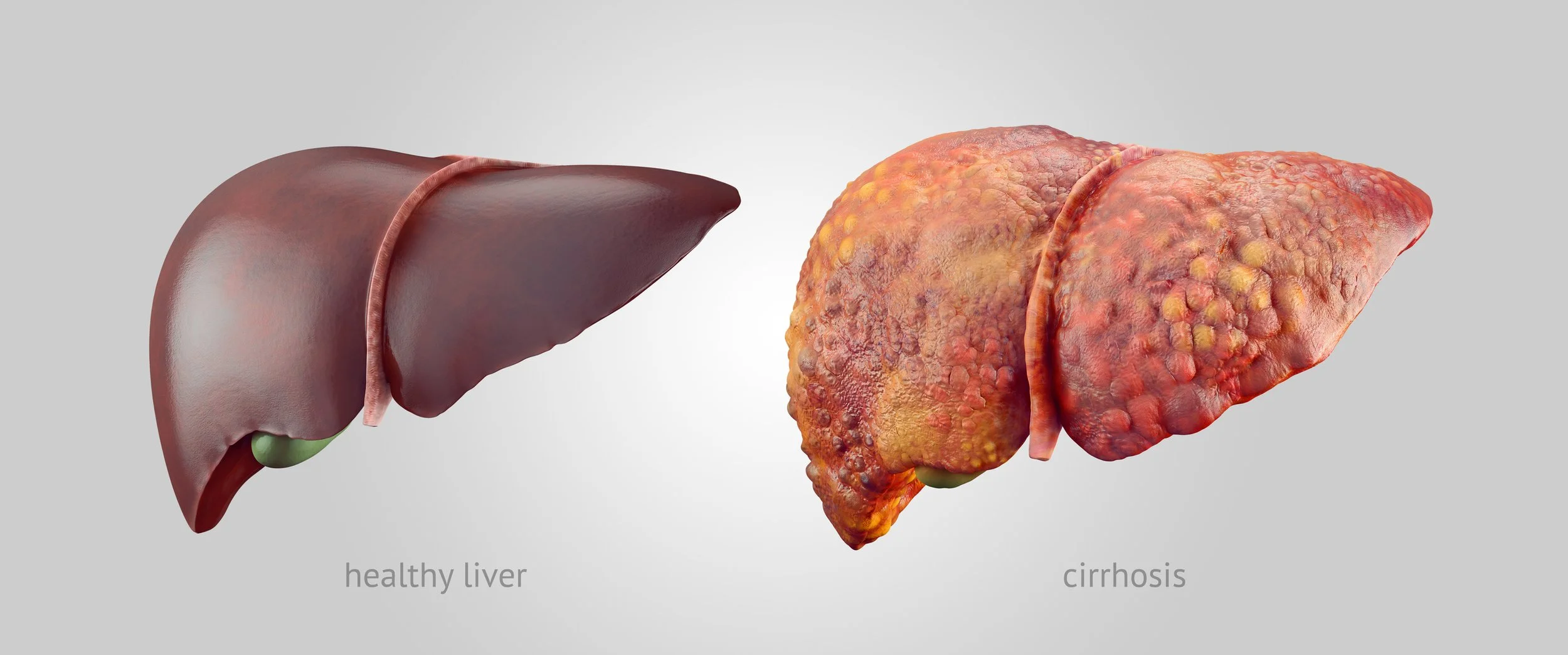 Hepatoprotective effects of Myricetin Powder Hepatoprotective effects of Myricetin Powder